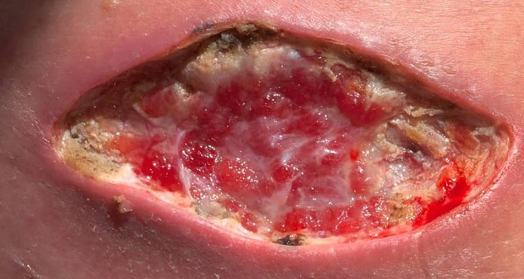 A skin-deep look and beyond